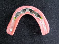 Denture base